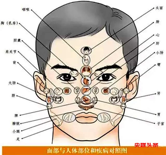 罗文礼治疗痛风方剂渊源如何将民族医药理论与现代医药相关